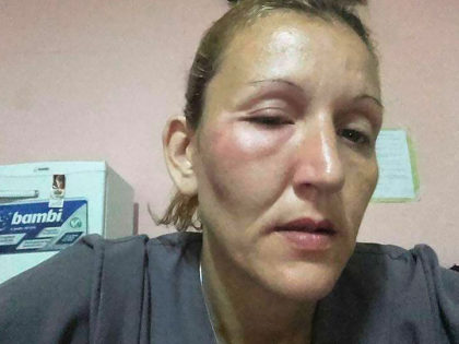 Fueron agredidos una empleada y un niño del Hogar de Abrigo Fueron agredidos una empleada y un niño del Hogar de Abrigo